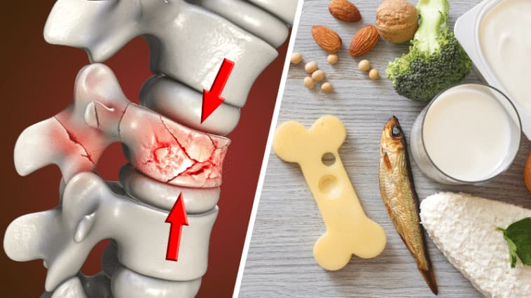 Renforcer la Santé des Os par l'Alimentation : 8 Indications et Conseils